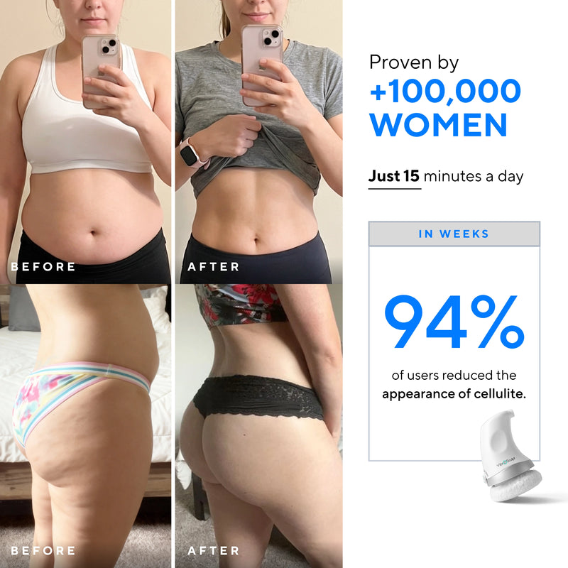 Vibro Sculpt - 6 Pads Included