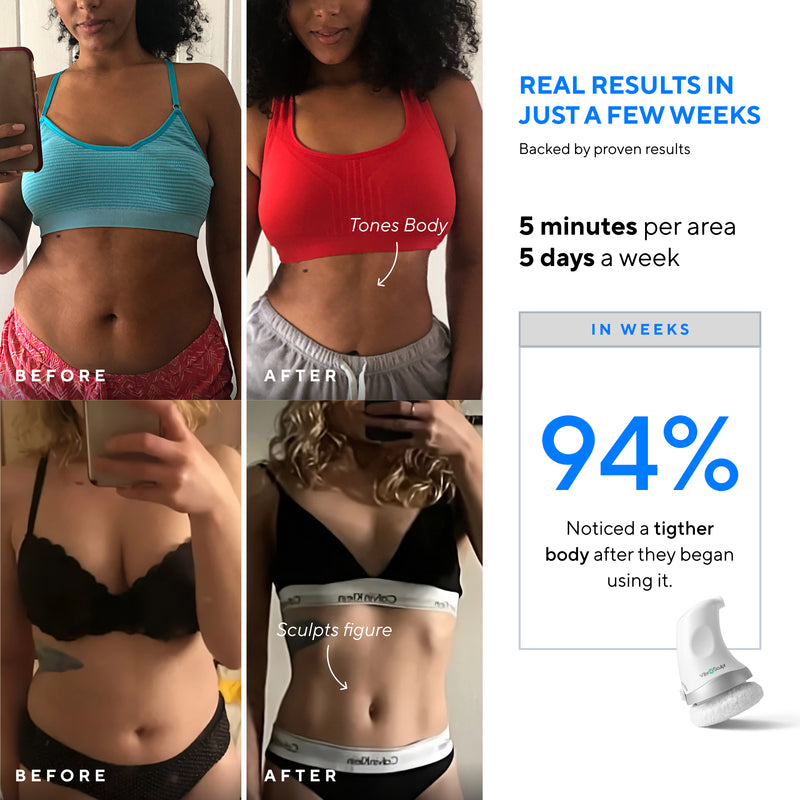 Vibro Sculpt - 6 Pads Included (UK)