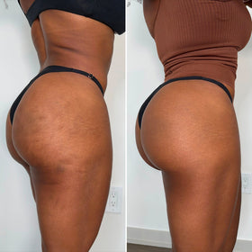 Before and after Nicolette
