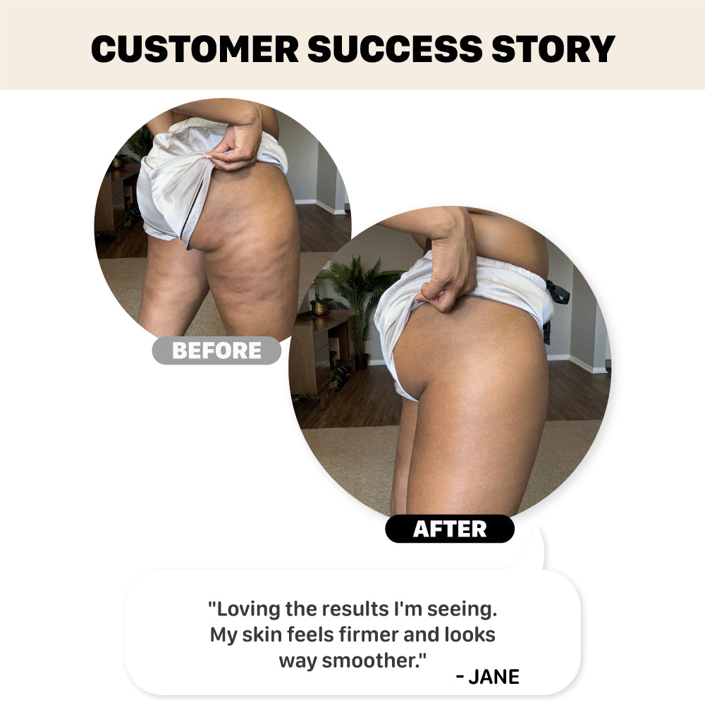 Smooth Firming Gel